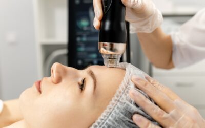 What Happens to Your Skin During a Radiofrequency Treatment?