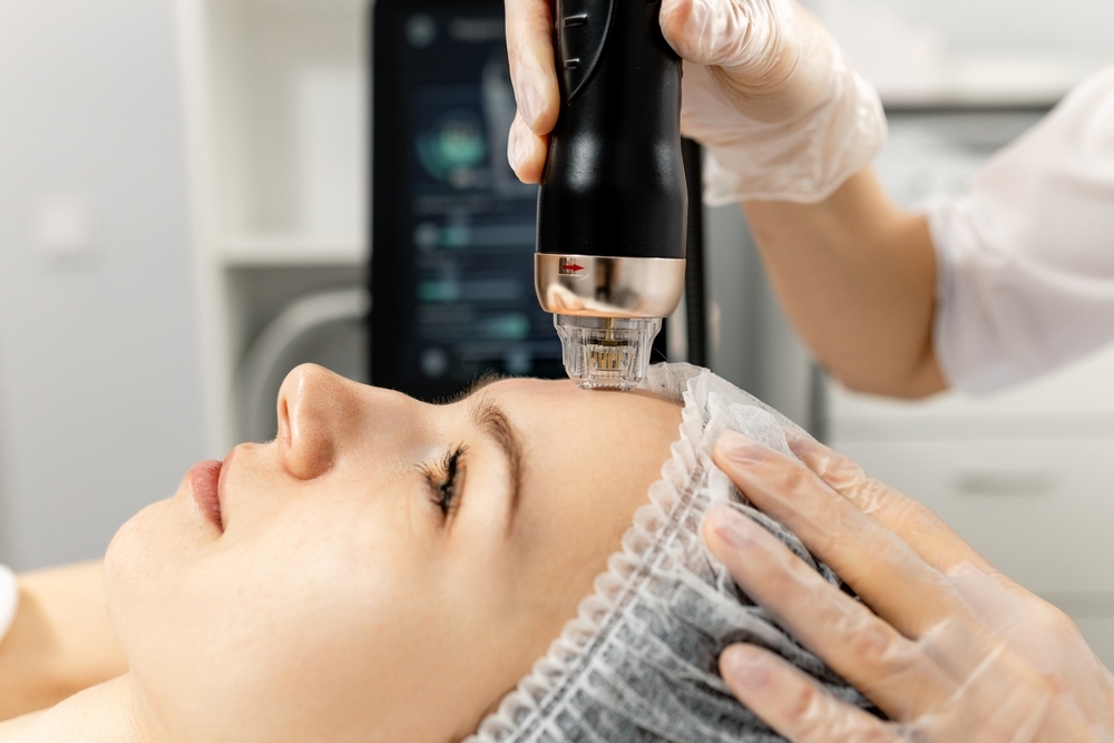 Woman receiving radiofrequency skin tightening treatment on face and jawline