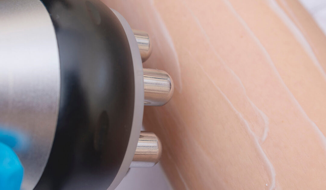 XERF skin tightening treatment using radiofrequency technology to stimulate collagen production