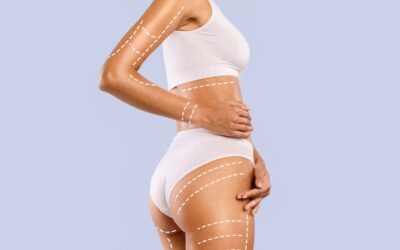 What Areas of the Body Can XERF Skin Tightening Treat?